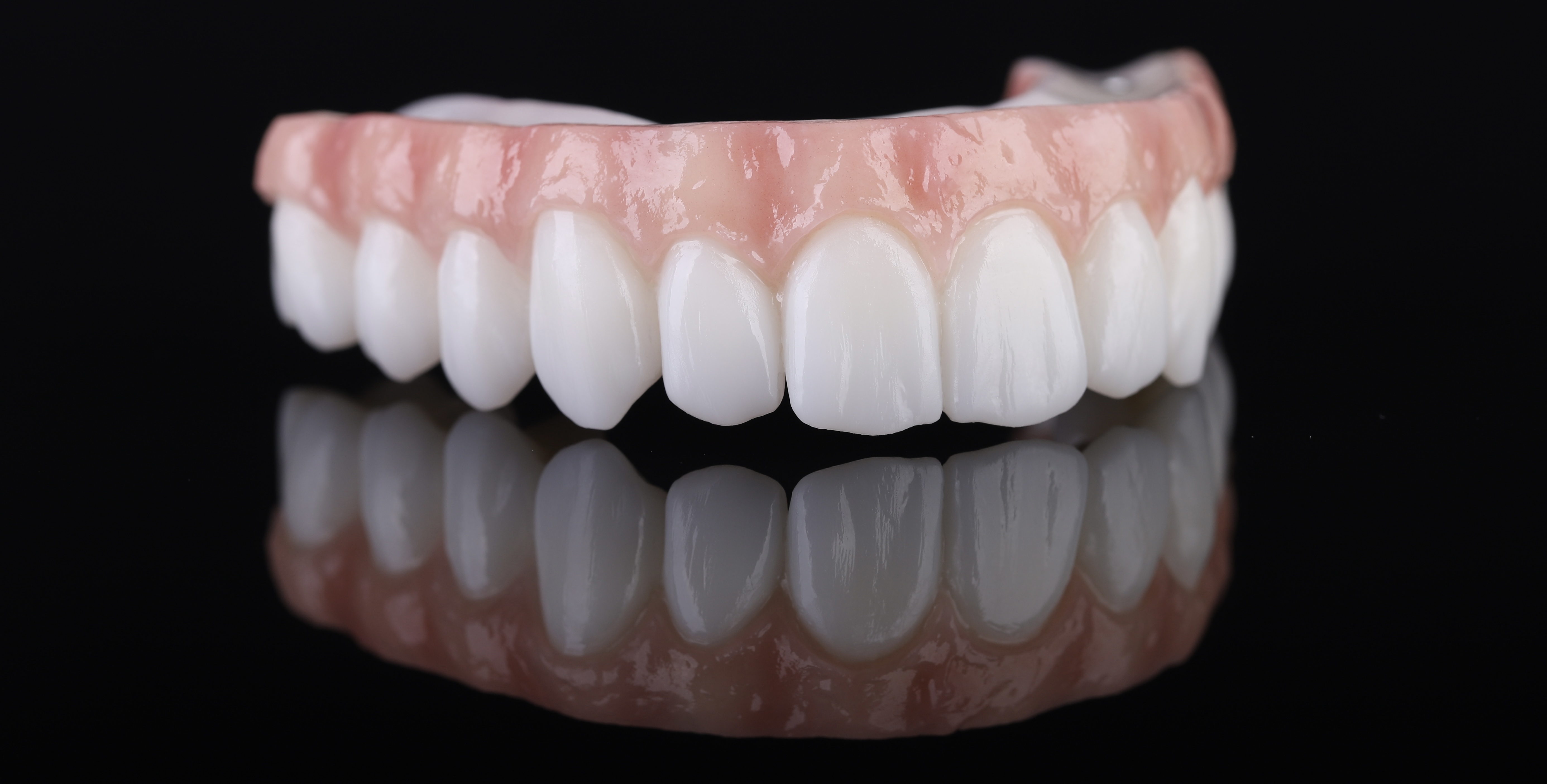 Dental restoration — Epic Dental Creations portfolio