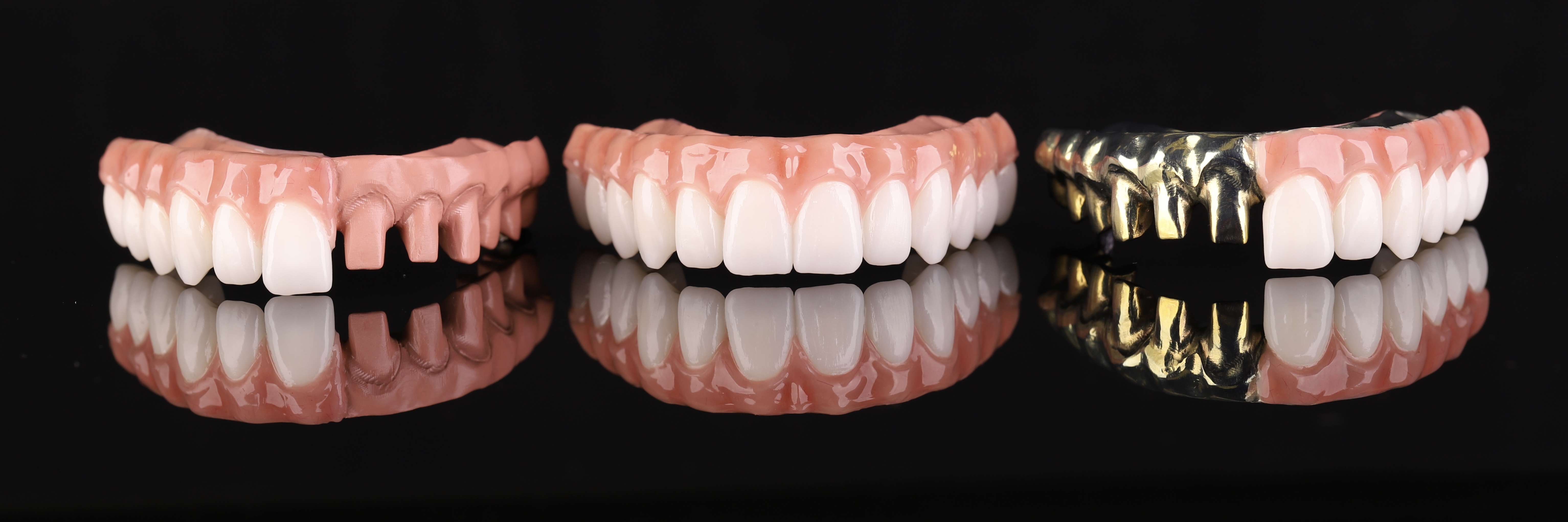 Dental restoration — Epic Dental Creations portfolio