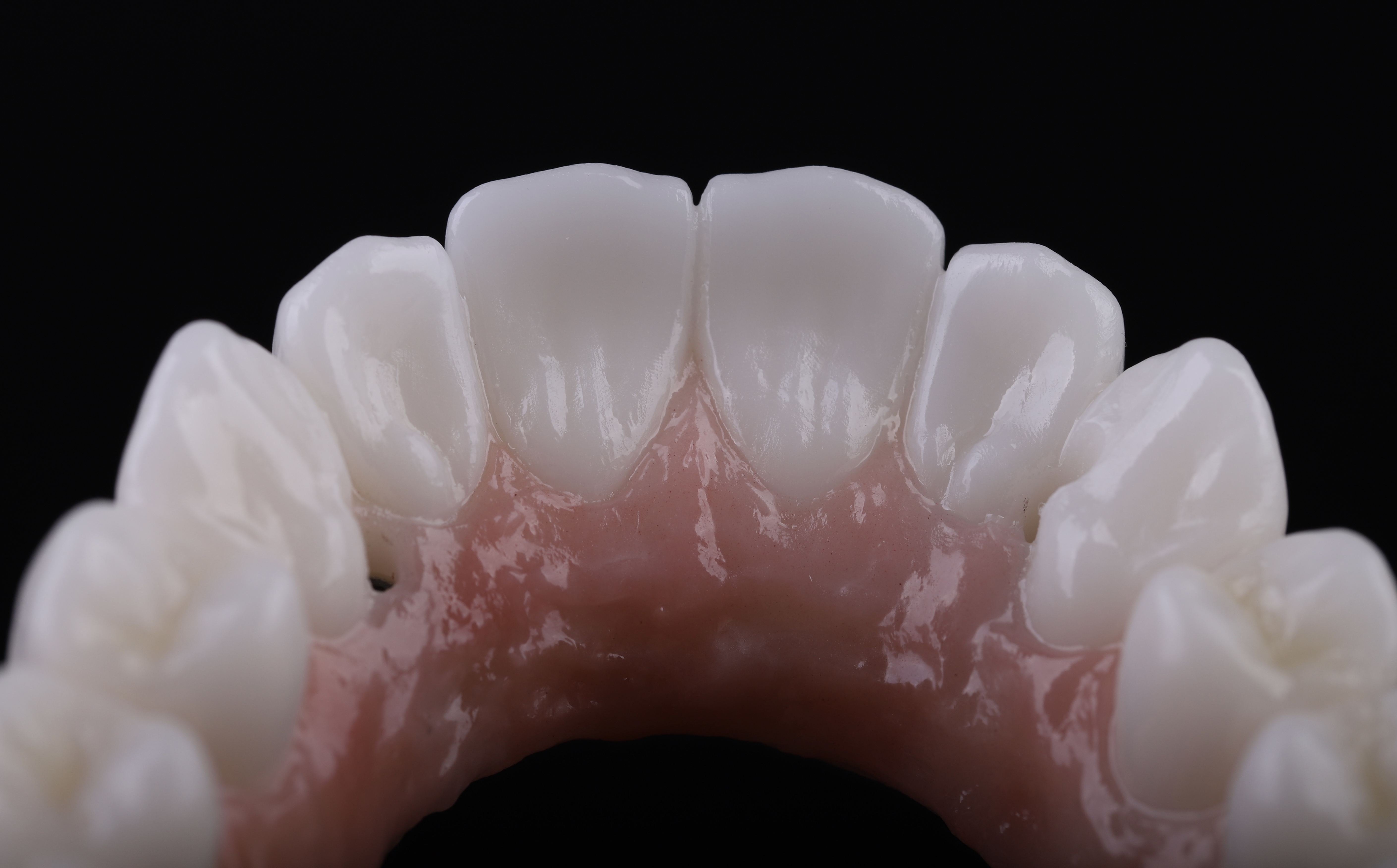 Dental restoration — Epic Dental Creations portfolio